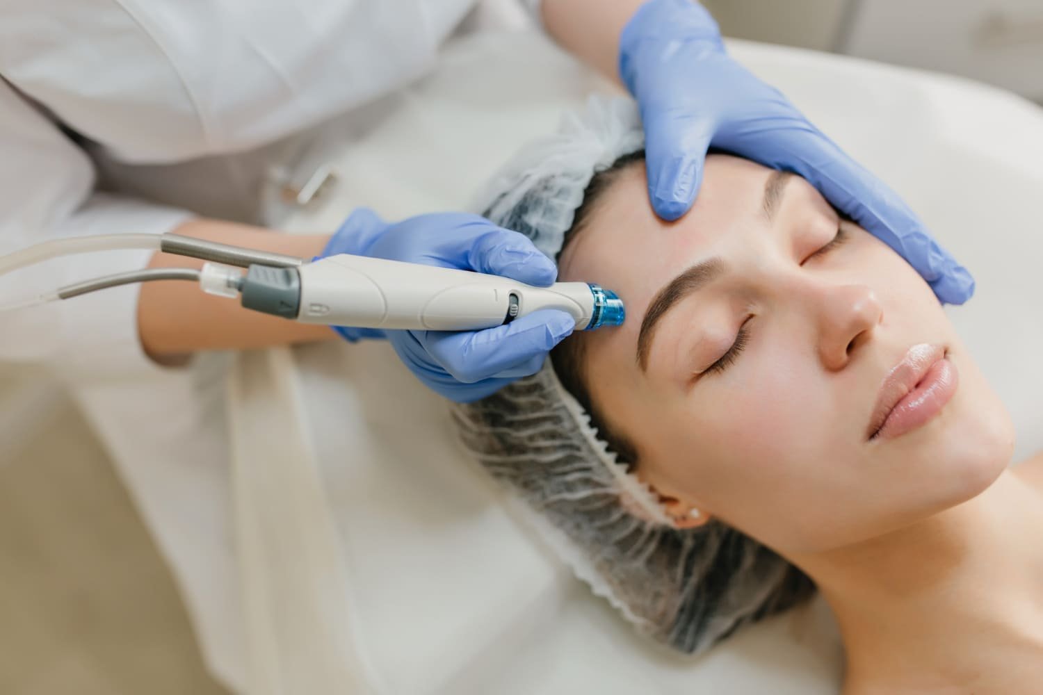 Melasma: Why It Keeps Coming Back & What Actually Works